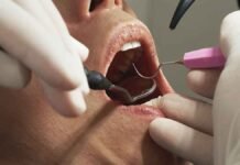 Prisma empresarial Una caries no atendida puede derivar en tratamientos que cuestan hasta 30 mil pesos por diente