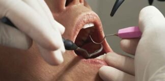 Prisma empresarial Una caries no atendida puede derivar en tratamientos que cuestan hasta 30 mil pesos por diente