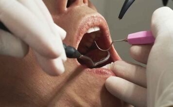 Prisma empresarial Una caries no atendida puede derivar en tratamientos que cuestan hasta 30 mil pesos por diente